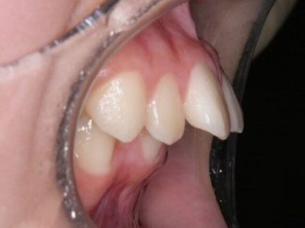 Before