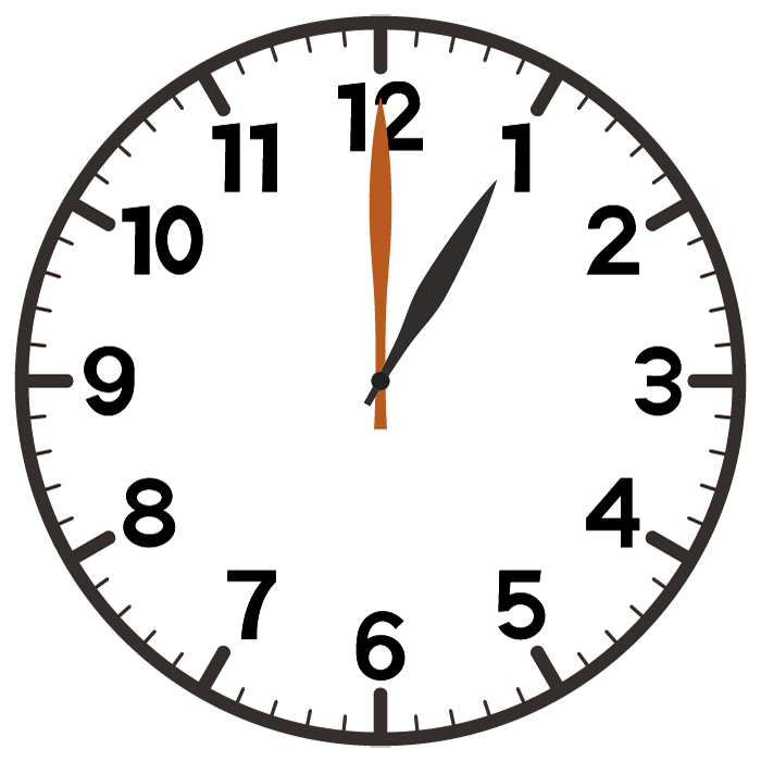 高槻市の歯医者、ゆいファミリー歯科・矯正歯科のむし歯治療の流れ